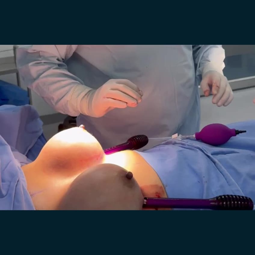 Renovarte | Innovación y precisión en cirugía plástica estética