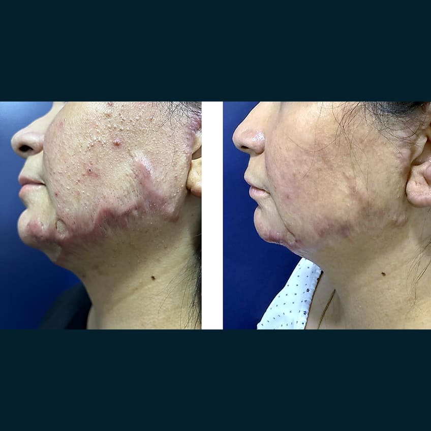 Renovarte | Innovación y precisión en cirugía plástica estética