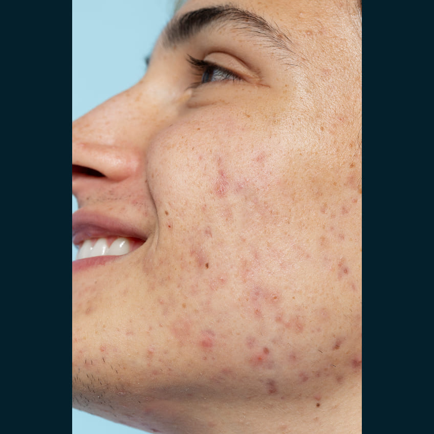 Renovarte | Innovación y precisión en cirugía plástica estética