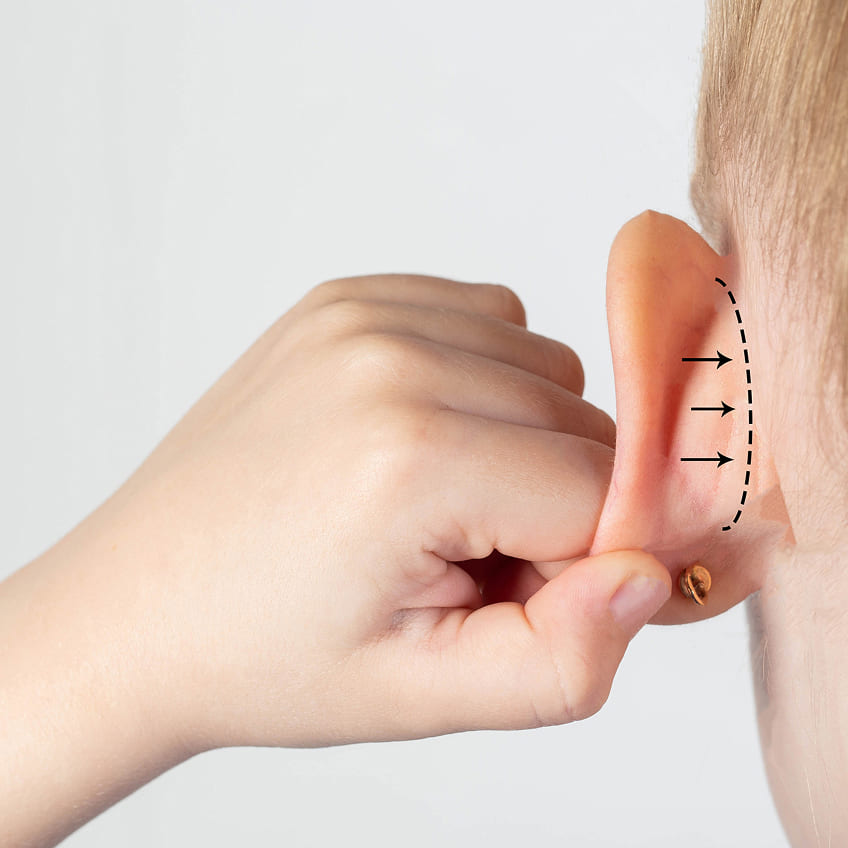 Renovarte | Innovación y precisión en cirugía plástica estética