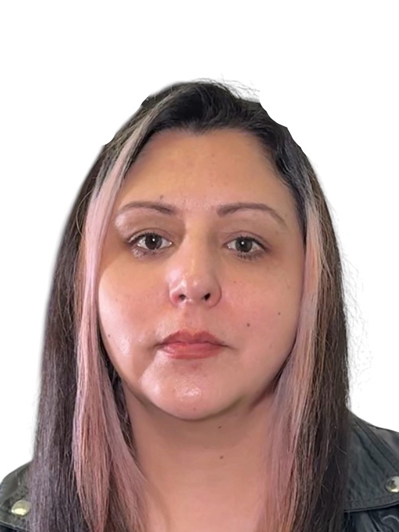 blefaroplastia-caso-3-despues