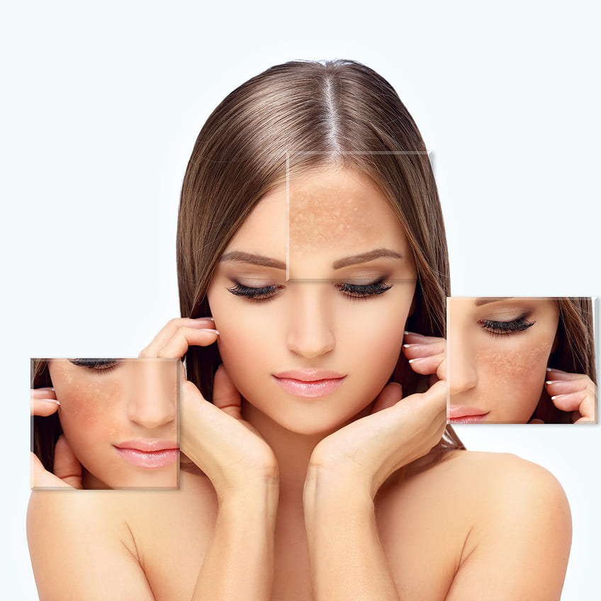 Renovarte | Innovación y precisión en cirugía plástica estética